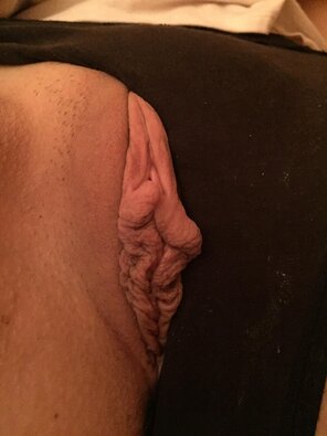amateur pic What do you think of these thick flaps?