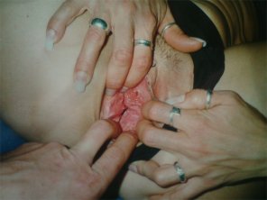 zdjęcie amatorskie Hand Finger Nail Flesh 