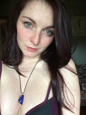 foto amateur Freckles