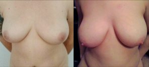 foto amateur Comparing 36D's on the left and 36E's on the right. A noticeable difference!