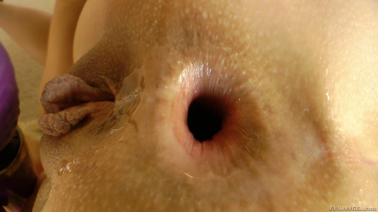 amateur photo analsex open hole_00666