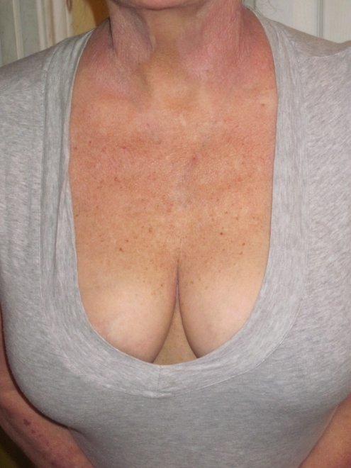 [Image] I think I may need a boob job. My hubby says I don't. What do you think? [F52]