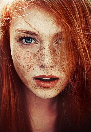 foto amatoriale Freckles