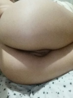 amateur pic [F] Is reddit fixed yet?