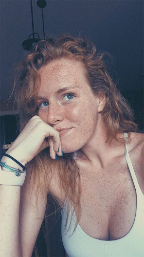 foto amateur Endless Freckles