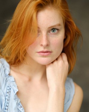 Red hair, blue eyes, and light freckles