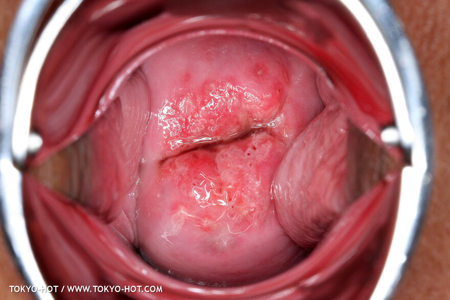 Berry Sawajiri-865 nude