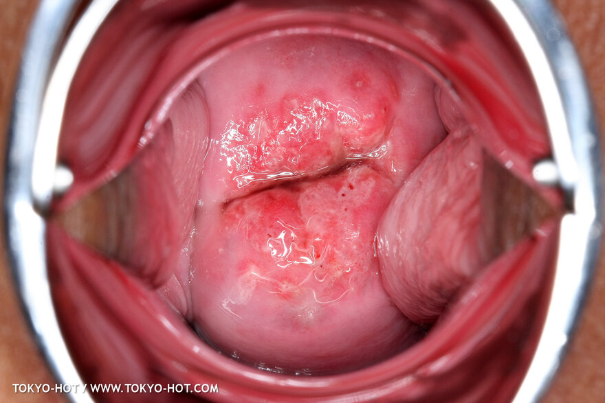 Berry Sawajiri-866 nude