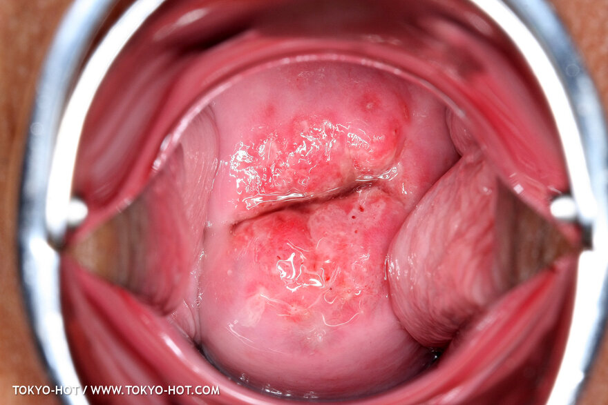 Berry Sawajiri-867 nude