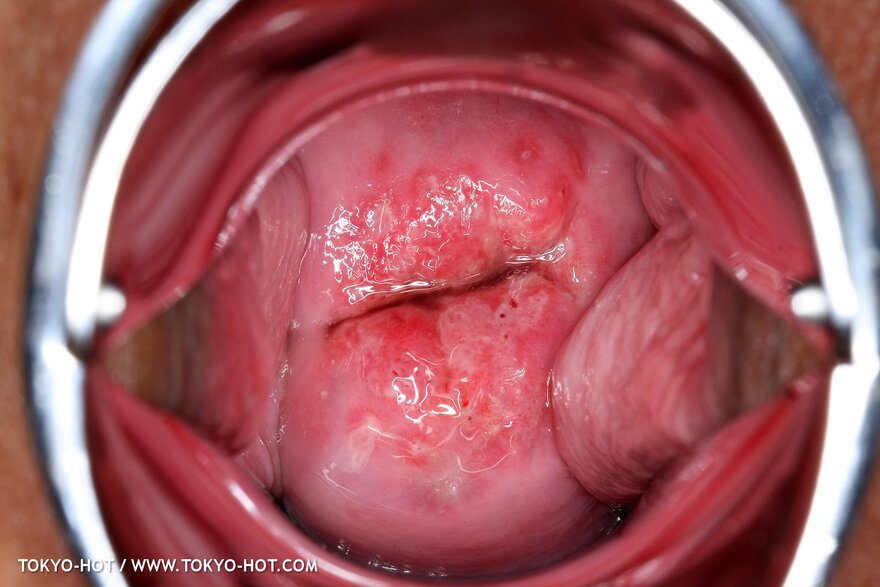 Berry Sawajiri-868 nude