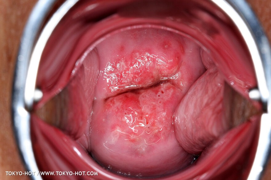 Berry Sawajiri-869 nude