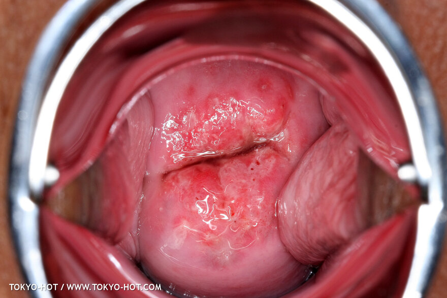 Berry Sawajiri-870 nude