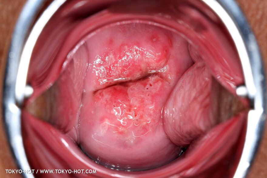 Berry Sawajiri-871 nude