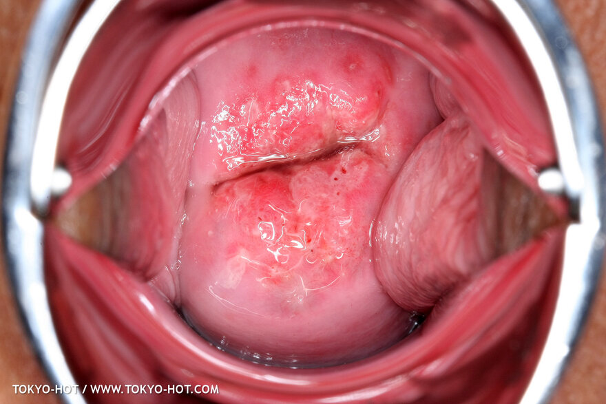 Berry Sawajiri-872 nude