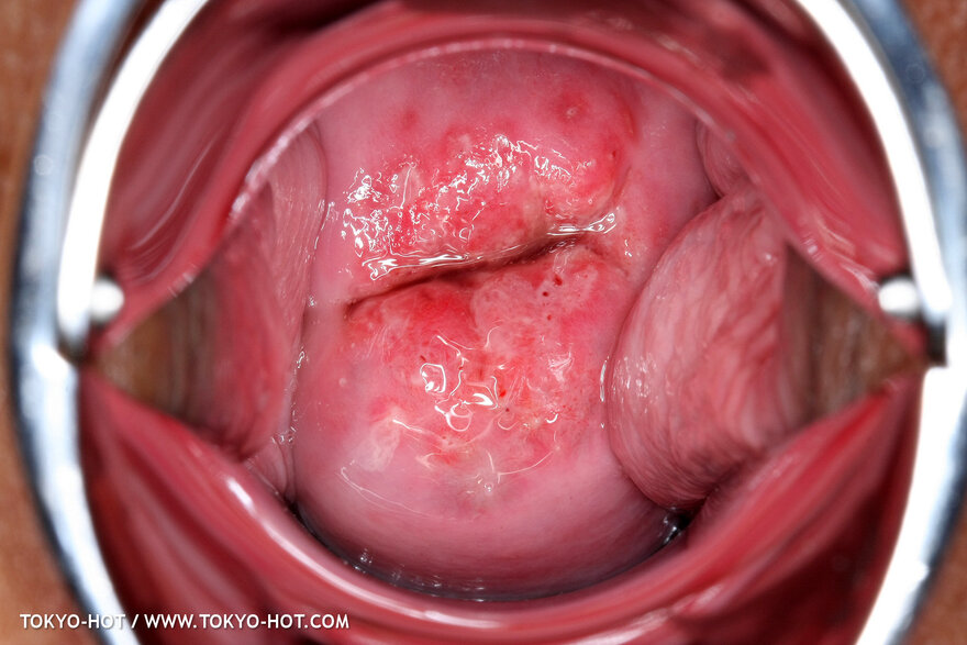 Berry Sawajiri-873 nude