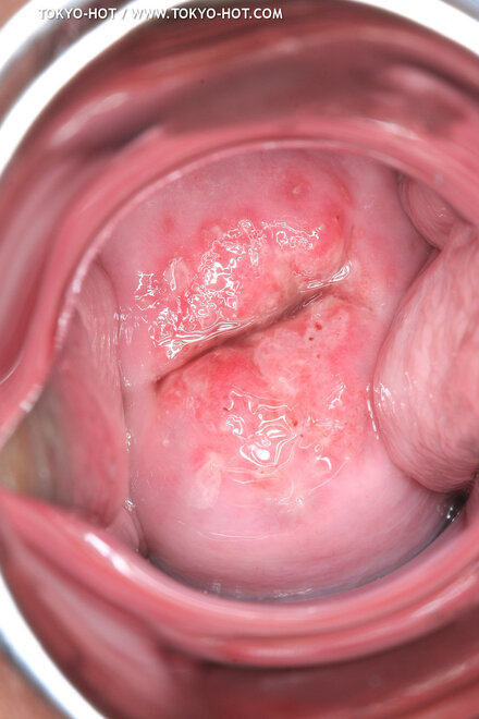 Berry Sawajiri-874 nude