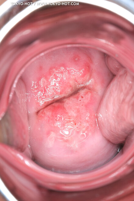 Berry Sawajiri-875 nude