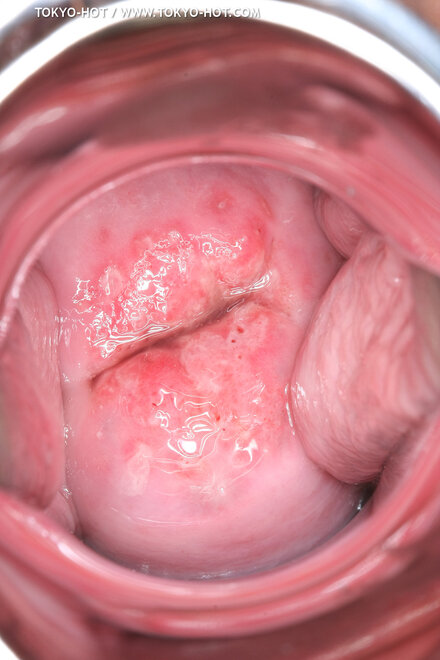 Berry Sawajiri-876 nude