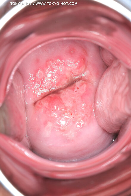 Berry Sawajiri-877 nude