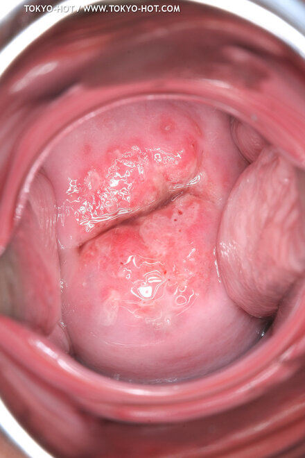 Berry Sawajiri-879 nude