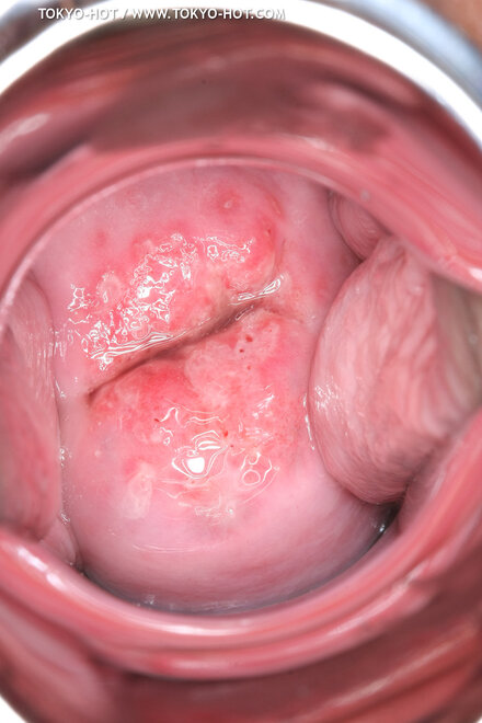 Berry Sawajiri-880 nude