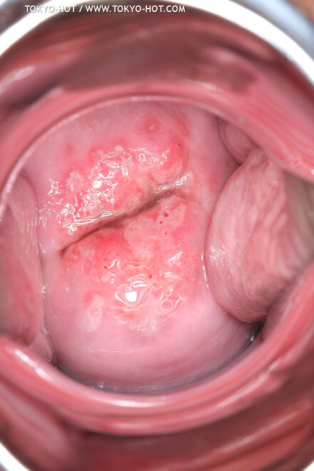 Berry Sawajiri-881 nude