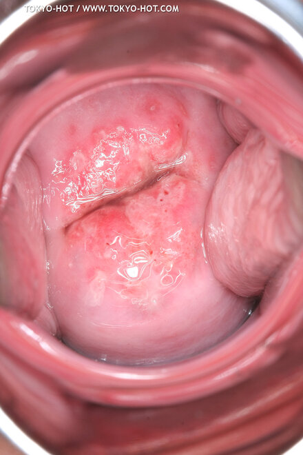 Berry Sawajiri-882 nude