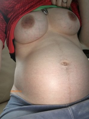 foto amatoriale Stomach Abdomen Skin Close-up Trunk 