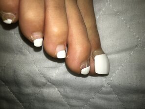 foto amadora Sexy outgrown mixed toenails