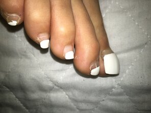 アマチュア写真 Sexy outgrown mixed toenails