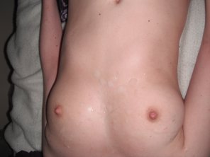 foto amatoriale Skin Abdomen Stomach Close-up Trunk 