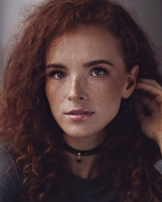 beauty with freckles
