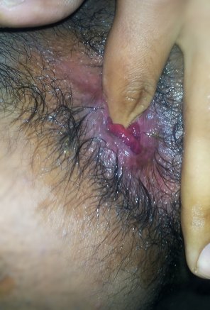 amateurfoto I feel my ass hole very hot and soft , wanna check it out ?