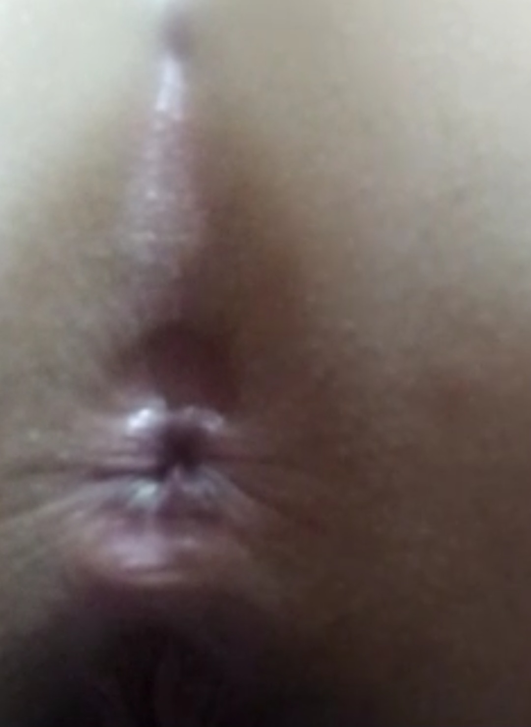 amateur photo 1000091591