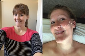 amateur photo Before And After Facial