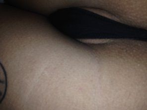 foto amateur Skin Close-up Arm Joint 
