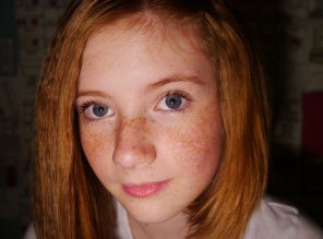 amateur-Foto Those freckles...