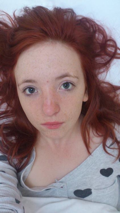 Freckles Are The Best [sfw] Porn Photo Eporner