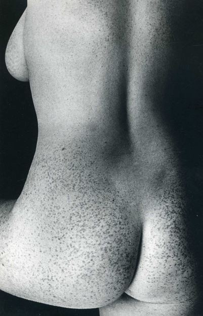 Freckled Body Porn Photo Eporner