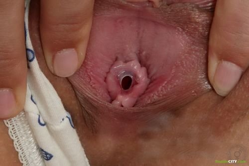 Extreme Closeup Of A Girl S Hymen Cherry Porn Photo