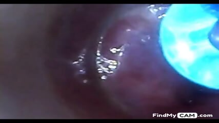 Test Tube Cock Endoscope POV Urethral Insertion Ball Rod