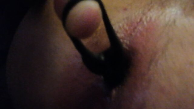 Huge Anal Plug tore anal sphincter